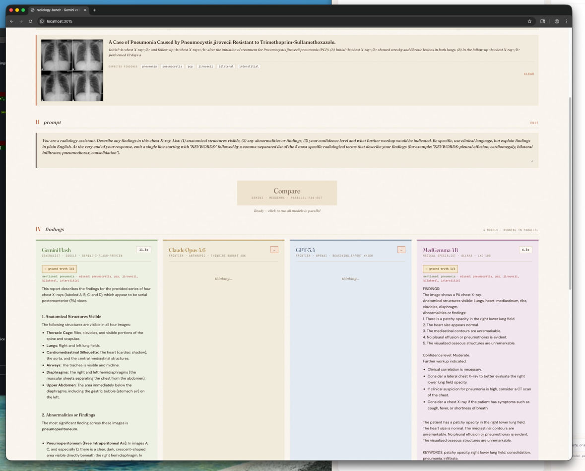 Radiology bench reconstructed interface